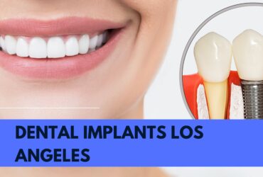 A Brief Idea Of How Dental Implant Restores Your Look