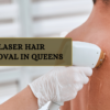 Why Choose Laser Hair Removal in Queens?