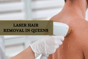 laser hair removal in queens