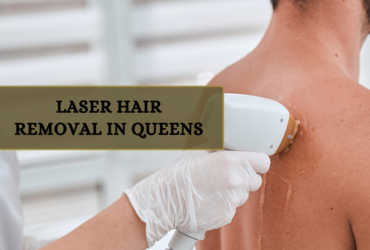 Why Choose Laser Hair Removal in Queens?