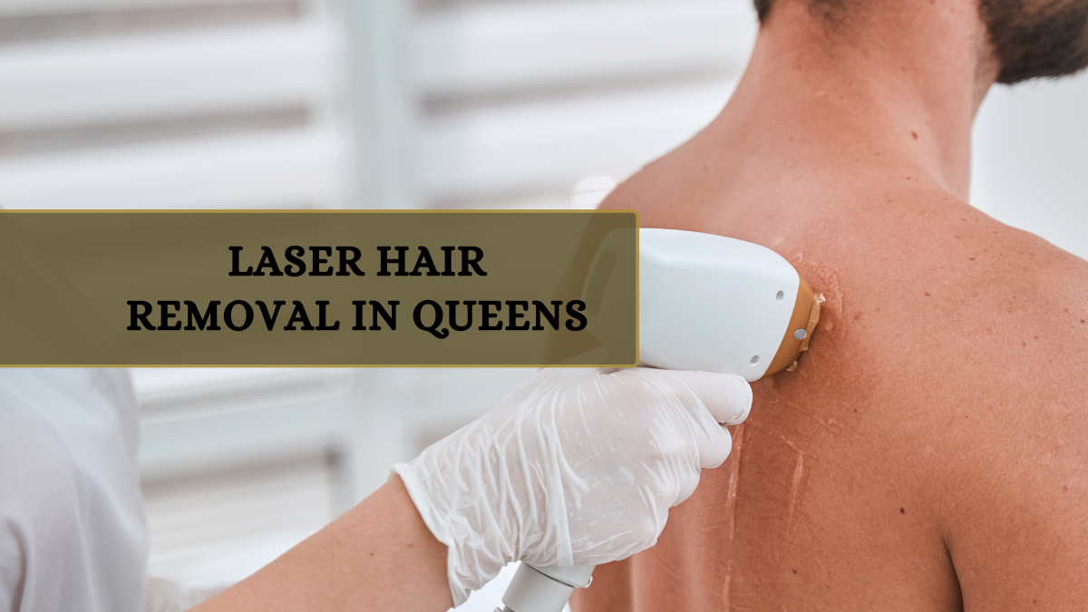 Why Choose Laser Hair Removal in Queens?