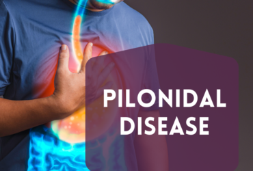 What Are Your Chances For Pilonidal Disease? Understand Your Body!