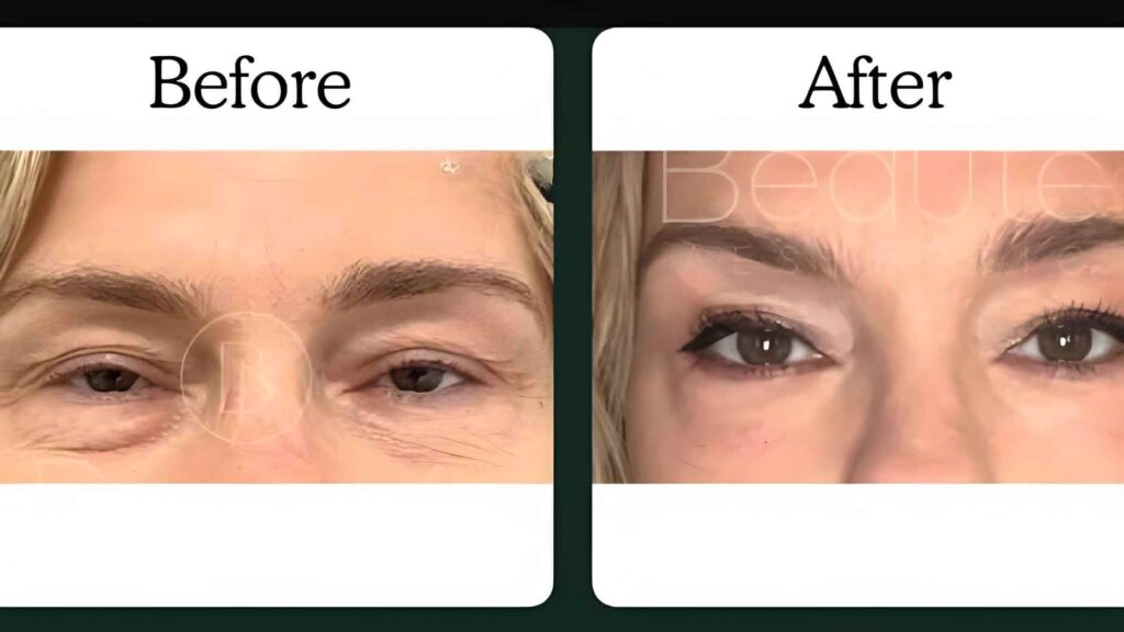 Results and Treatment Timeline 